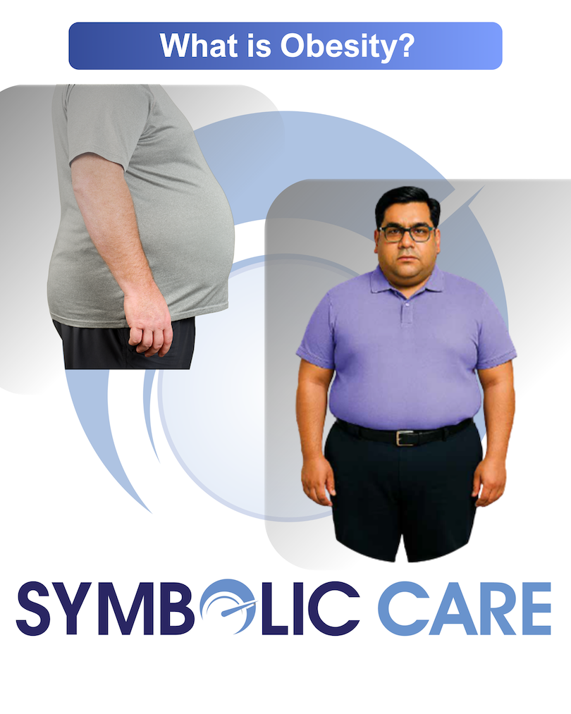 Illustration for understanding obesity